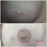micropigmentación areolas en Barcelona