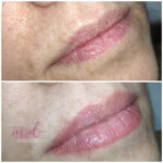 micropigmentación labios Barcelona