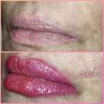 micropigmentación labios Barcelona