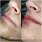 micropigmentación labios Barcelona