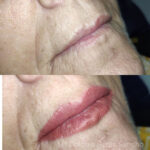 micropigmentación labios Barcelona