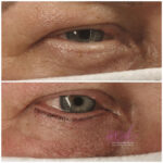 micropigmentación de ojos en Barcelona