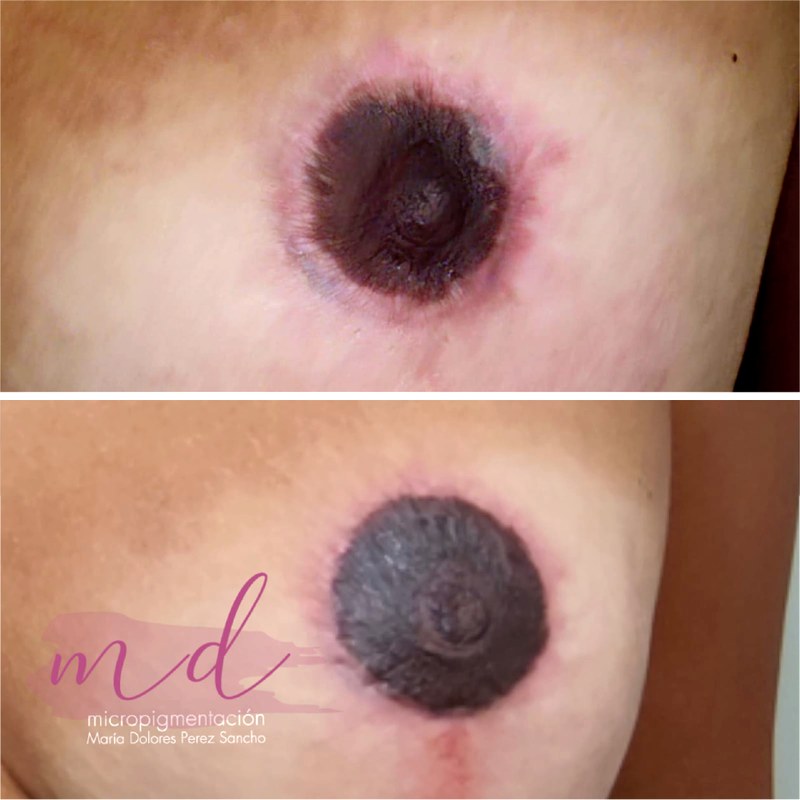 Areola_069