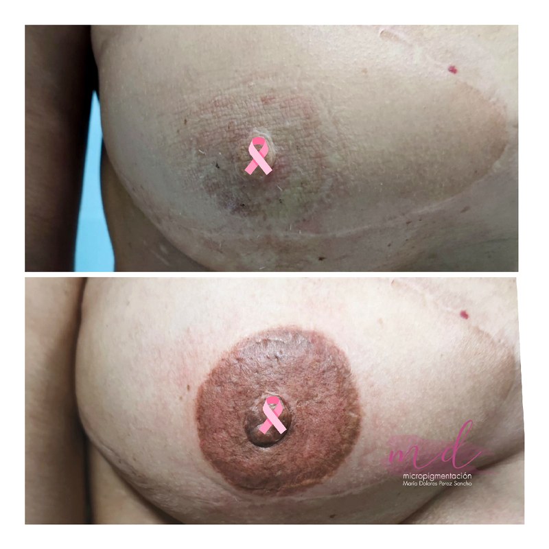 Areola_074