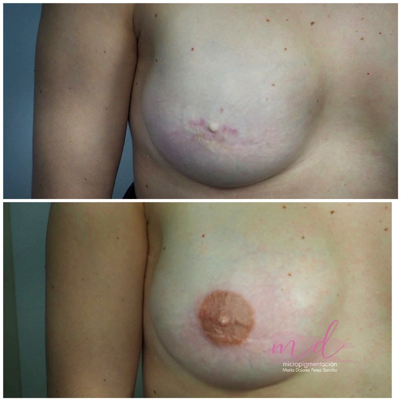 Areola_081