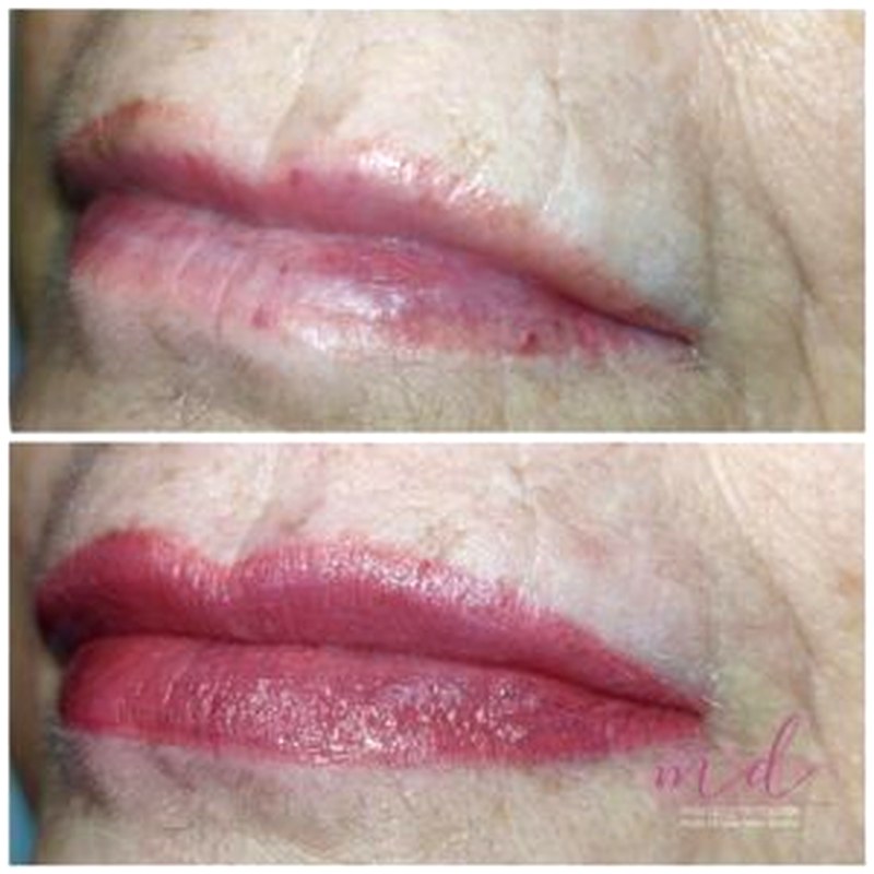 Labios_002