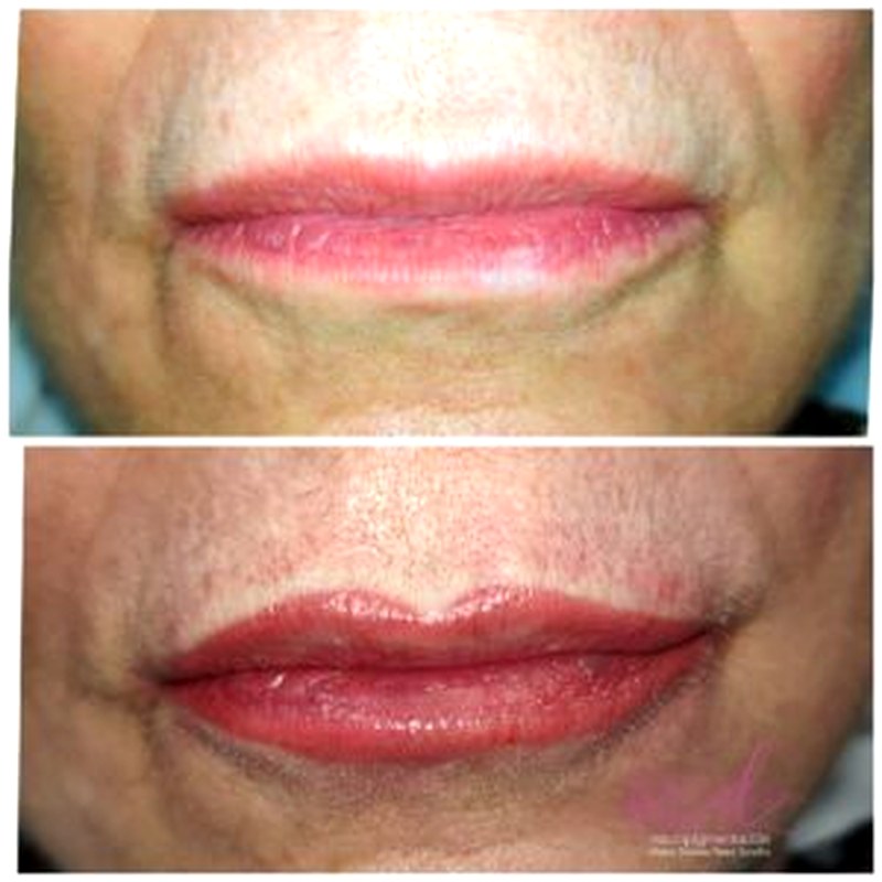 Labios_005