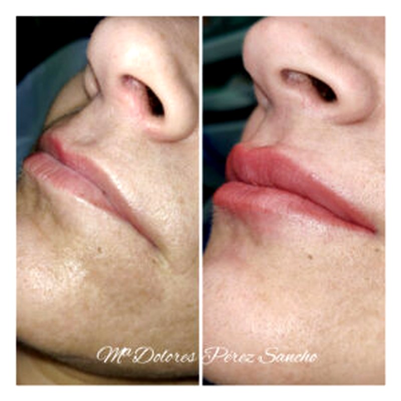 Labios_006