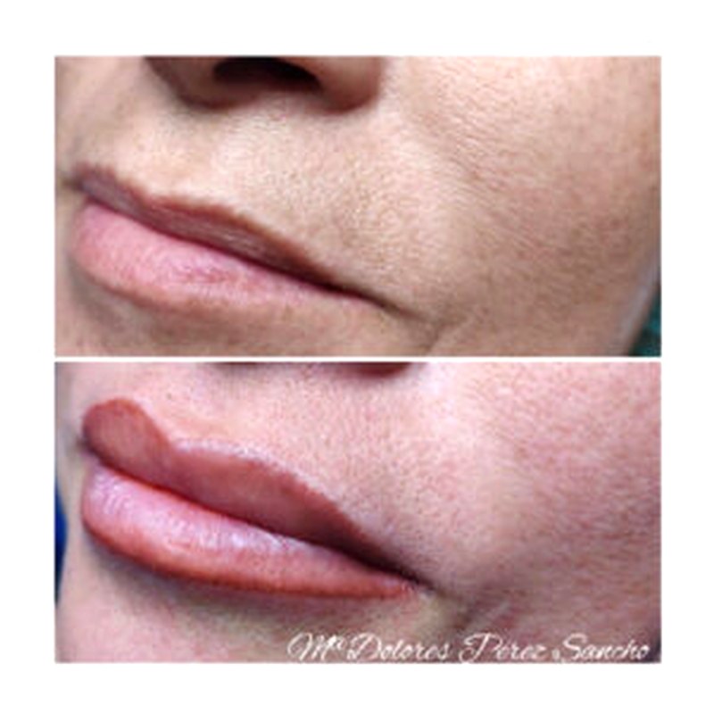 Labios_007