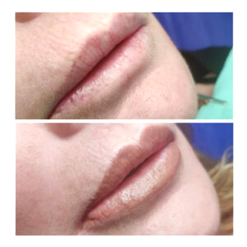 Labios_008