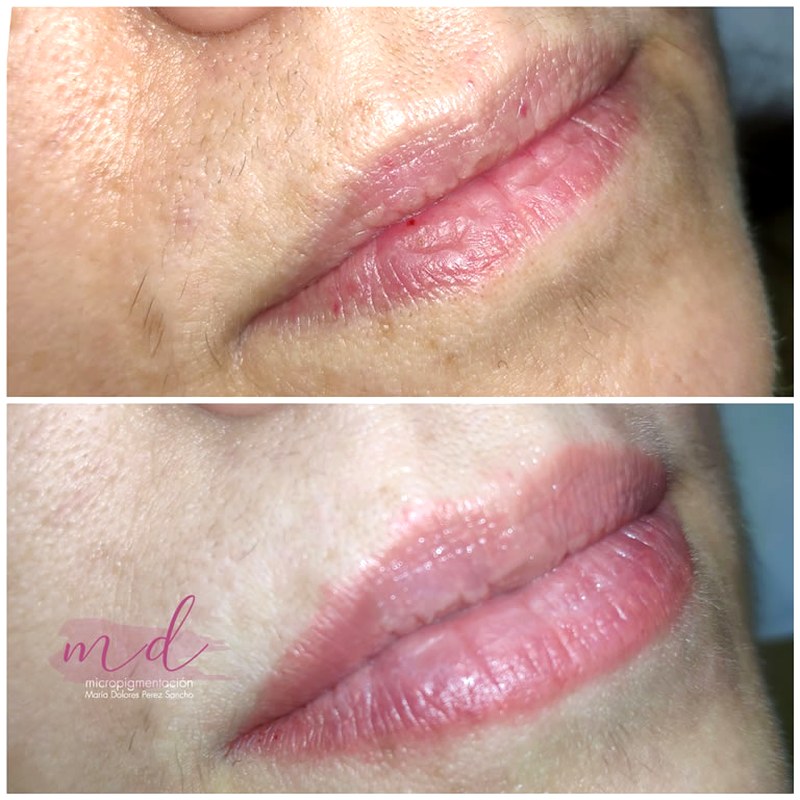 Labios_010