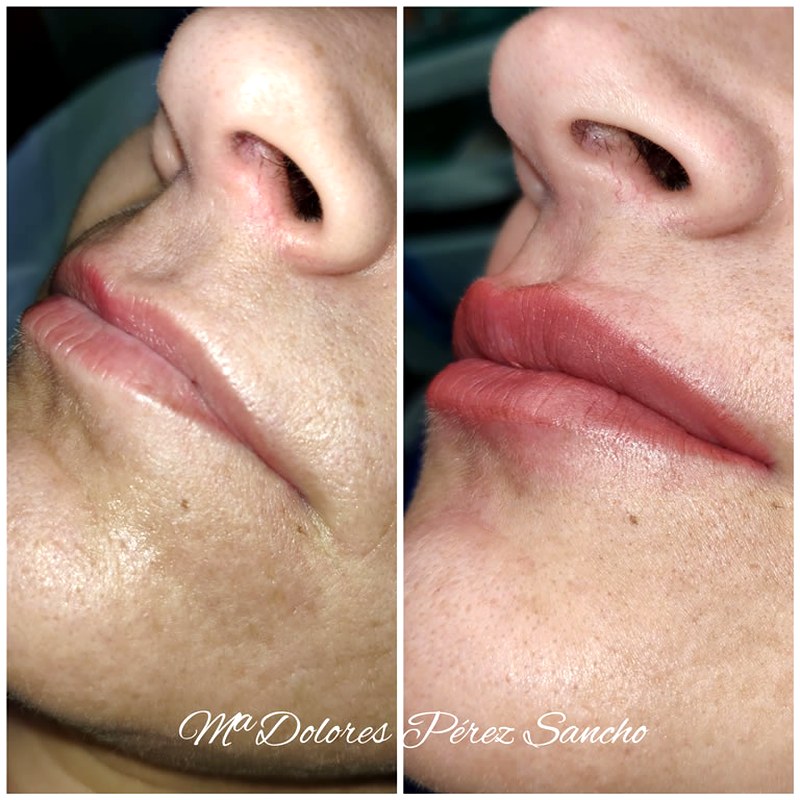 Labios_013