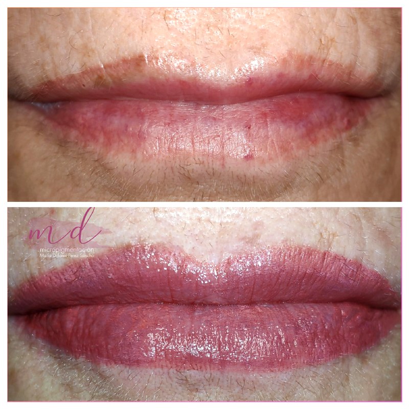 Labios_028