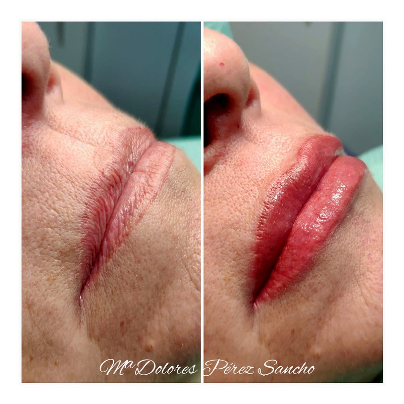Labios_030