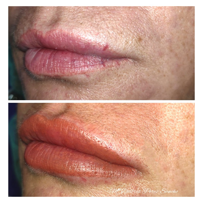 Labios_031