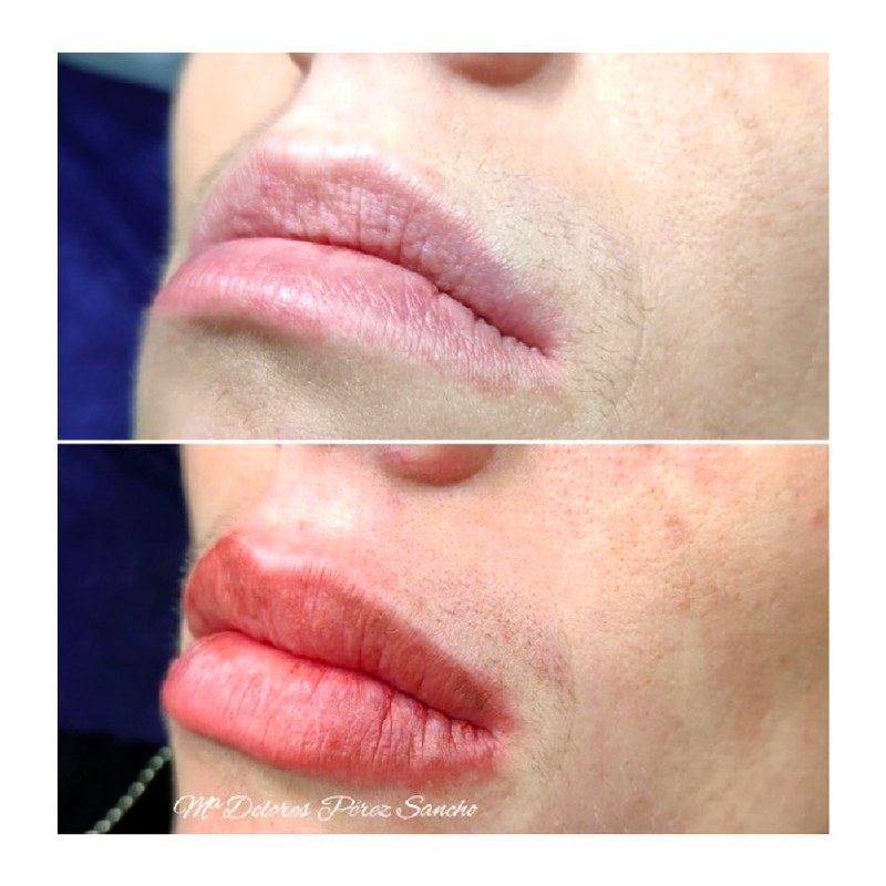 Labios_033