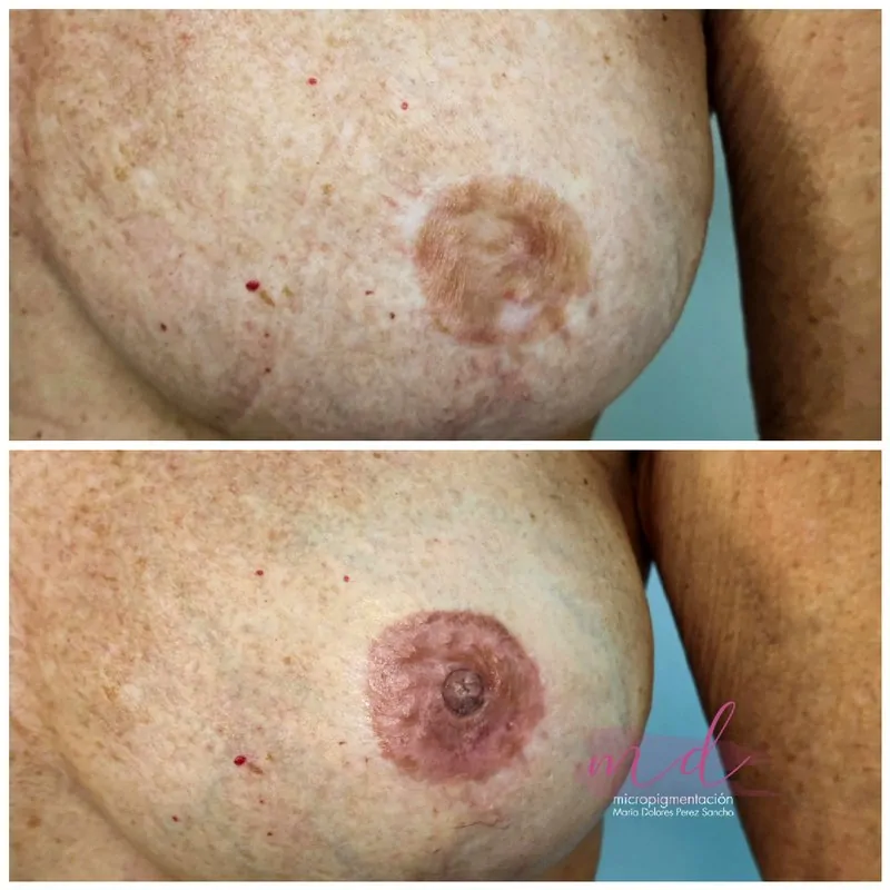 Micropigmentación areola efecto 3D hiperrealista Barcelona
